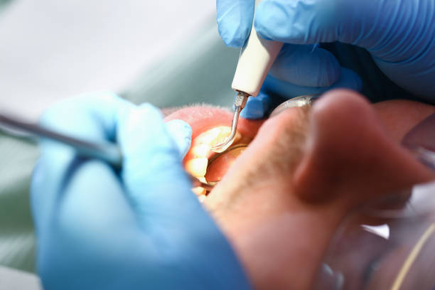 Best Walk-In Emergency Dental Services in Spencer, WV