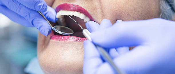 Best Urgent Dental Care for Toothaches in Spencer, WV